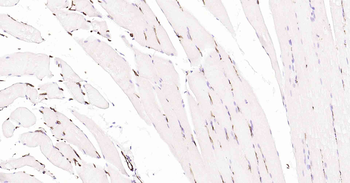 AQP1 Recombinant Rabbit Monoclonal Antibody