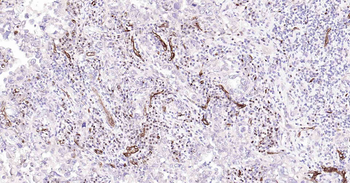 AQP1 Recombinant Rabbit Monoclonal Antibody