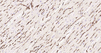 AQP1 Recombinant Rabbit Monoclonal Antibody