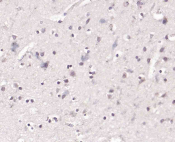 Phospho-GSK3B (Ser9) Rabbit Polyclonal Antibody