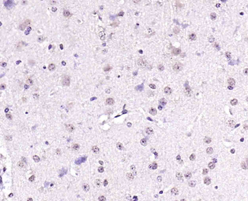 GSK3B Rabbit Polyclonal Antibody