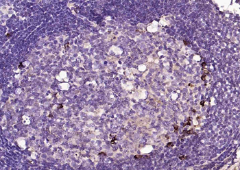 Human Lambda chain Mouse Monoclonal Antibody
