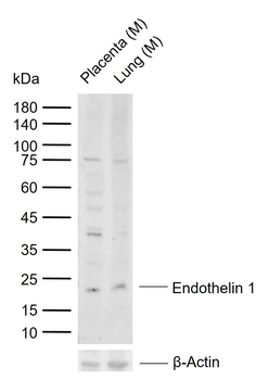 Endothelin 1 Rabbit Polyclonal Antibody