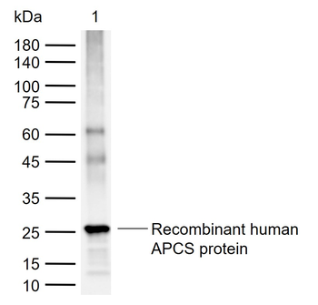 APCS Rabbit Polyclonal Antibody