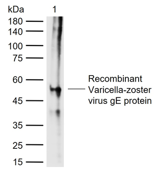 VZV gE Rabbit Polyclonal Antibody