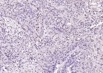 PPARGC1A Rabbit Polyclonal Antibody