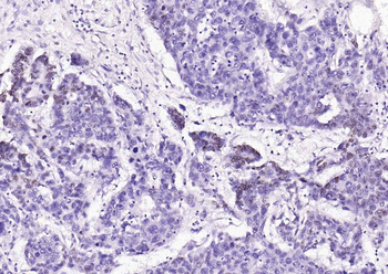 PPARGC1A Rabbit Polyclonal Antibody