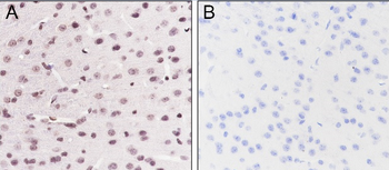 Acetyl Lysine Recombinant Rabbit Monoclonal Antibody
