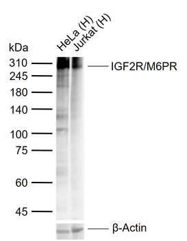 IGF2R/M6PR Recombinant Rabbit Monoclonal Antibody