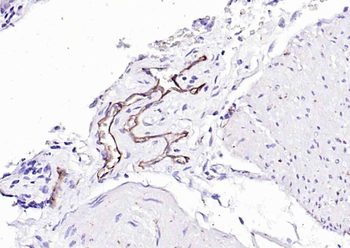 CD62p Recombinant Rabbit Monoclonal Antibody