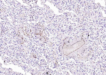 CD62p Recombinant Rabbit Monoclonal Antibody