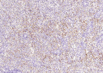 CD62p Recombinant Rabbit Monoclonal Antibody
