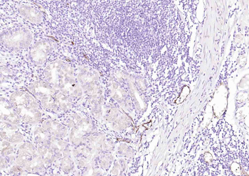 CD62p Recombinant Rabbit Monoclonal Antibody