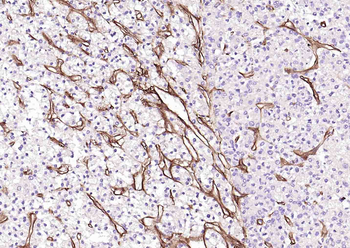 Collagen IV Recombinant Rabbit Monoclonal Antibody