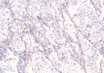 Collagen IV Recombinant Rabbit Monoclonal Antibody