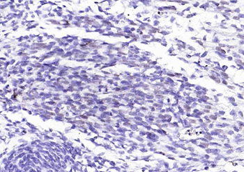 Myogenin Recombinant Rabbit Monoclonal Antibody