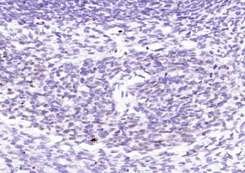 Myogenin Recombinant Rabbit Monoclonal Antibody