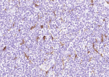 IL18 Recombinant Rabbit Monoclonal Antibody