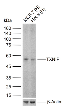TXNIP Recombinant Rabbit Monoclonal Antibody
