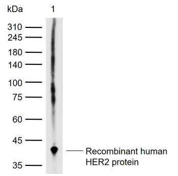 ERBB2/HER2 Rabbit Polyclonal Antibody