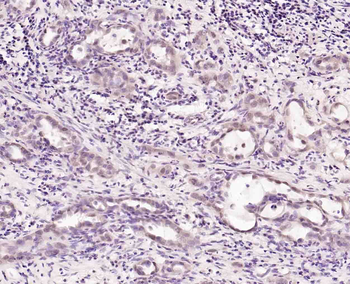 POLK Rabbit Polyclonal Antibody