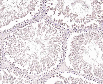 POLK Rabbit Polyclonal Antibody