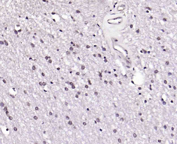 Phospho-alpha B Crystallin (Ser19) Rabbit Polyclonal Antibody