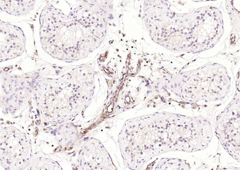 HLA E Rabbit Polyclonal Antibody