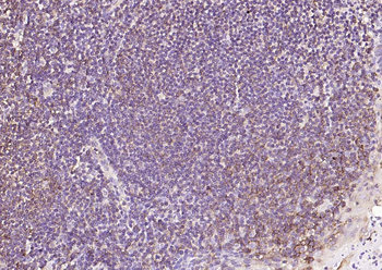 HLA E Rabbit Polyclonal Antibody