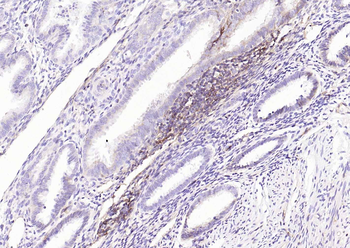 HLA E Rabbit Polyclonal Antibody