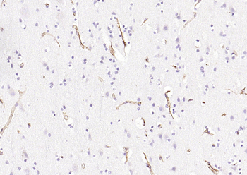 HLA E Rabbit Polyclonal Antibody