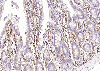 HLA E Rabbit Polyclonal Antibody