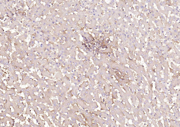 HLA E Rabbit Polyclonal Antibody