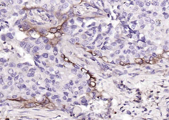 HLA E Rabbit Polyclonal Antibody