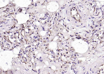 HLA E Rabbit Polyclonal Antibody