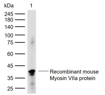 Myosin VIIa Recombinant Rabbit Monoclonal Antibody