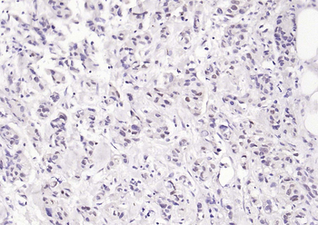GATA3 Recombinant Rabbit Monoclonal Antibody