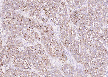 HE4 Mouse Monoclonal Antibody