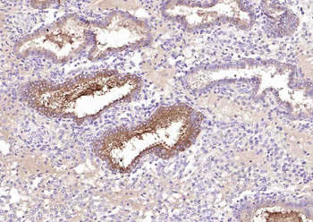 HE4 Mouse Monoclonal Antibody