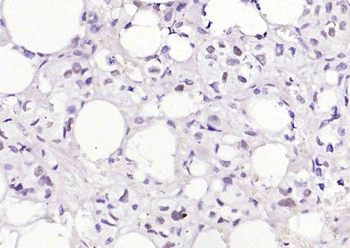 ZCWCC1 Rabbit Polyclonal Antibody