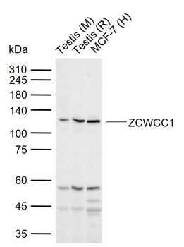 ZCWCC1 Rabbit Polyclonal Antibody