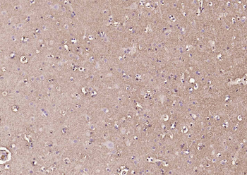EAAT2 Rabbit Polyclonal Antibody