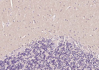 EAAT2 Rabbit Polyclonal Antibody