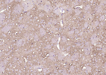 EAAT2 Rabbit Polyclonal Antibody