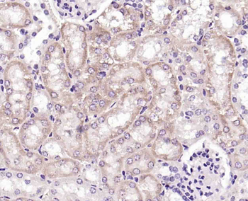 Phospho-WNK1 (Thr60) Rabbit Polyclonal Antibody