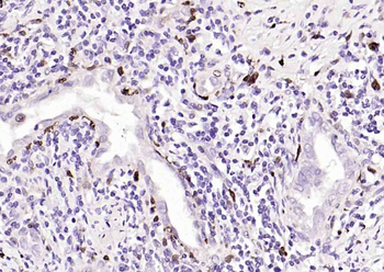 S100-A8/A9 Rabbit Polyclonal Antibody