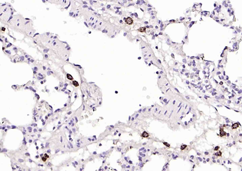 S100-A8/A9 Rabbit Polyclonal Antibody