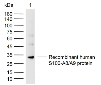 S100-A8/A9 Rabbit Polyclonal Antibody