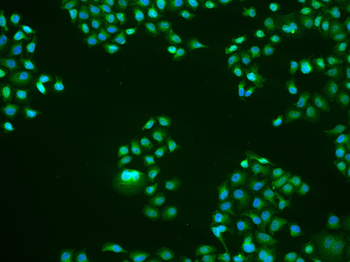 KLF10 Rabbit Polyclonal Antibody