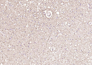 NEFM Recombinant Rabbit Monoclonal Antibody